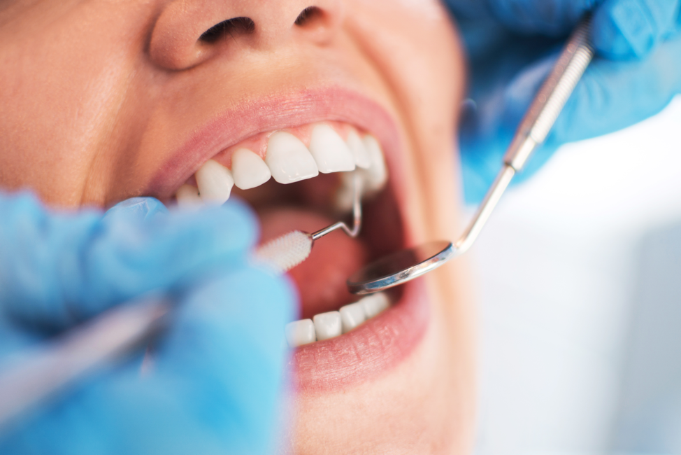 Free Dental Care: A Complete Guide